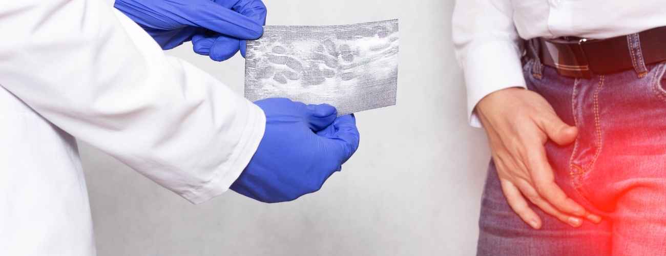 Hydrocele Surgery