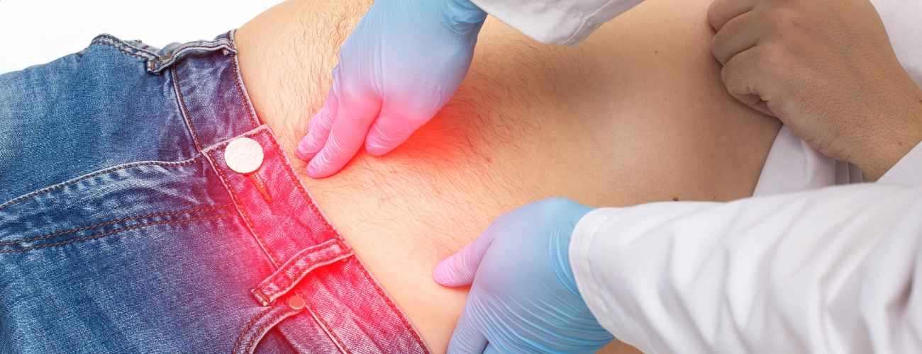 Radikale Zystektomie bei Blasenkrebs