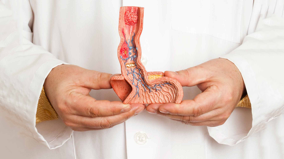 Penile Cancer Treatment